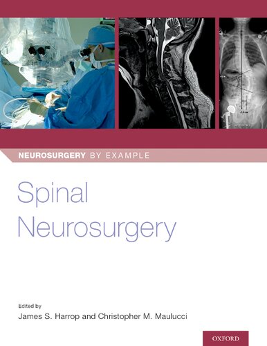 Spinal Neurosurgery 1st Edition James Harrop Editor Christopher Maulucci Editor