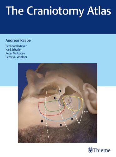 The Craniotomy Atlas 1st Edition Andreas Raabe Bernhard Meyer