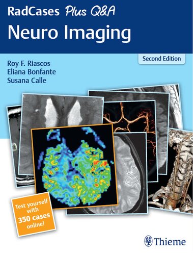 Radcases Plus Q A Neuro Imaging Second Susana Calle Editor Eliana Bonfante Editor Roy Riascos Editor