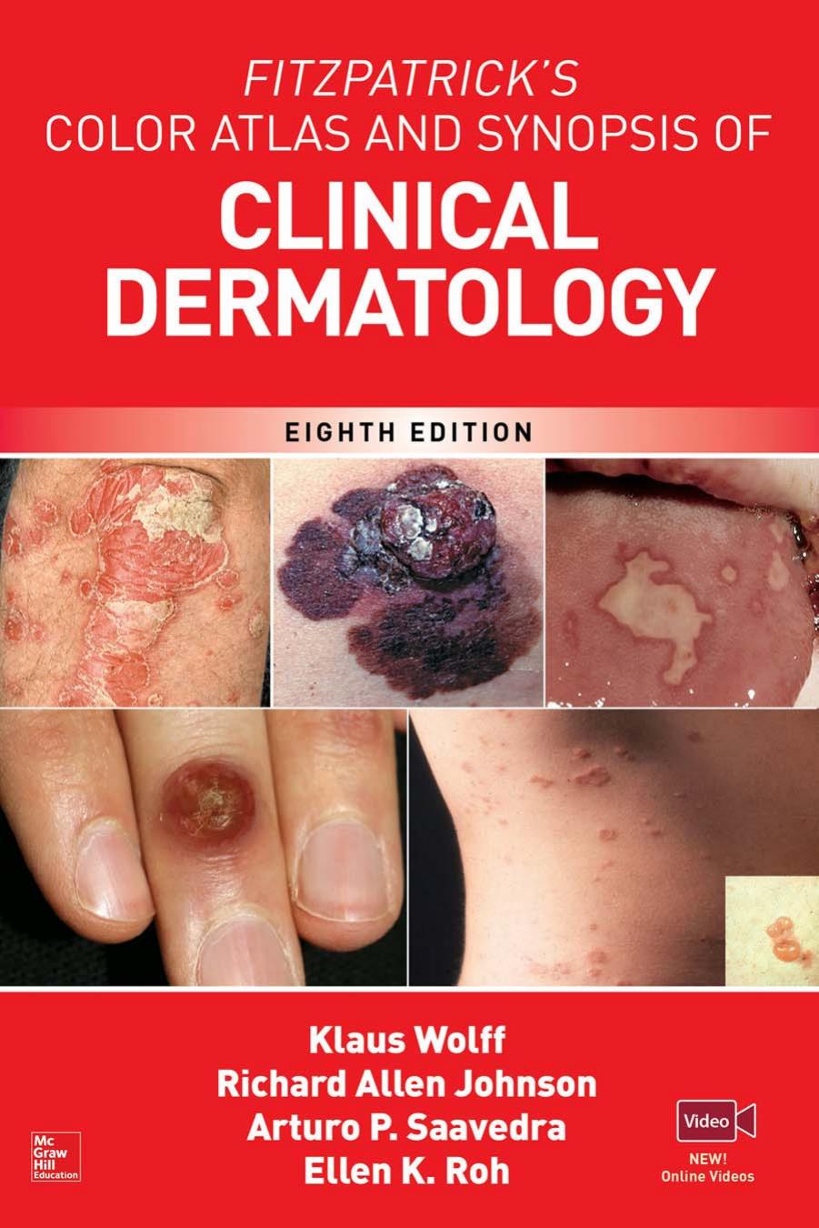 Fitzpatricks Color Atlas And Synopsis Of Clinical Dermatology 8th Edition 8th Edition Klaus Wolff