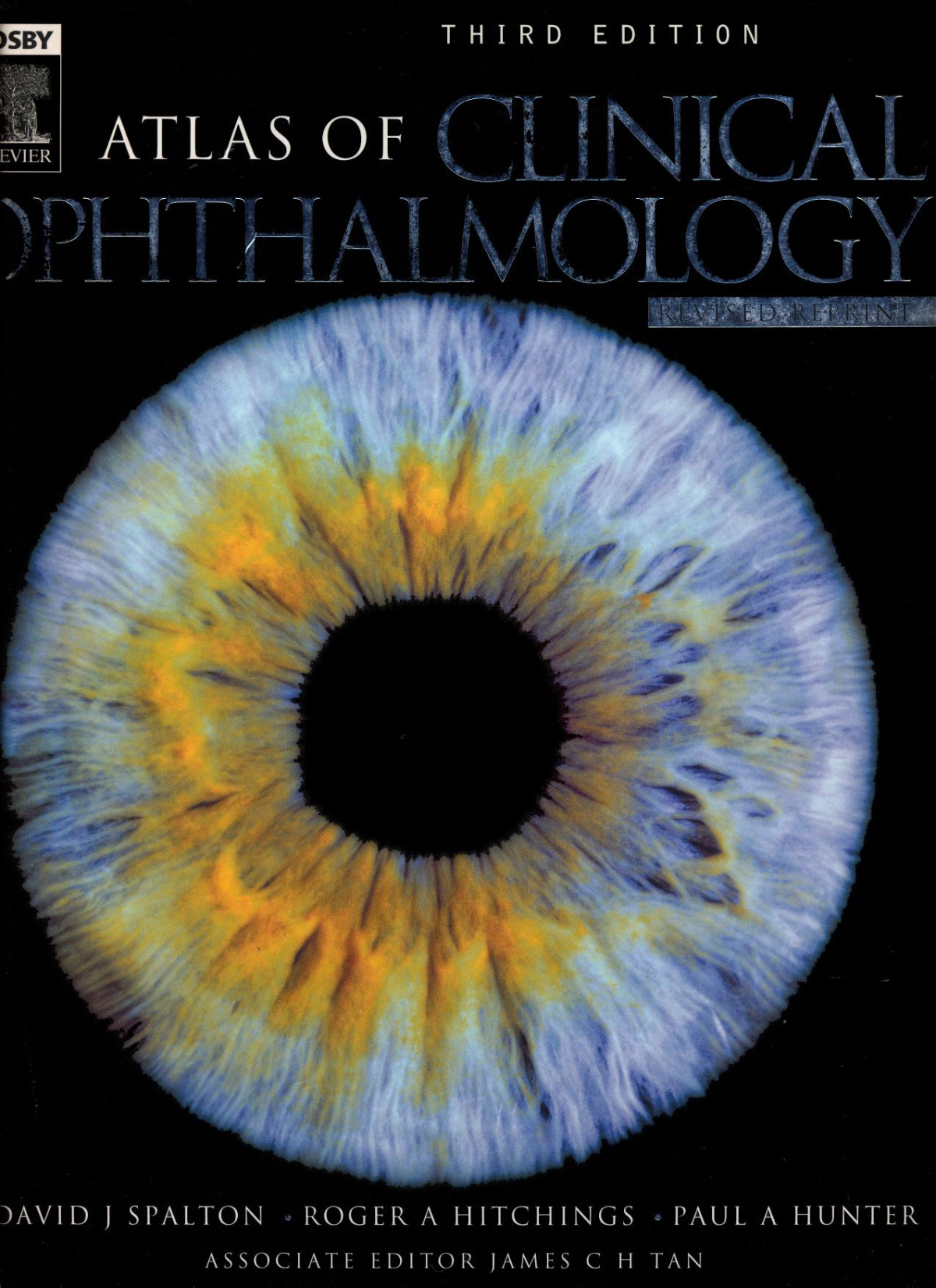 Atlas Of Clinical Ophthalmology Third Edition 3rd Edition David J Spalton