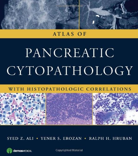 Atlas Of Pancreatic Cytopathology With Histopathologic Correlations 1st Edition Syed Ali Md