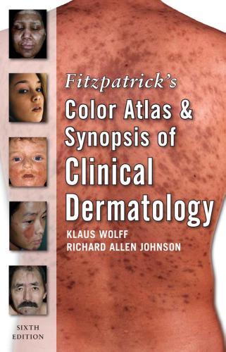 Fitzpatricks Color Atlas And Synopsis Of Clinical Dermatology 6th Klaus Wolff