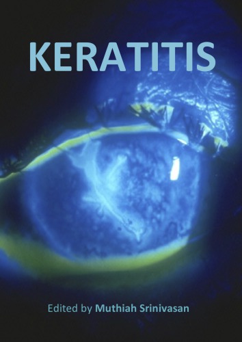 Keratitis Edited By Muthiah Srinivasan