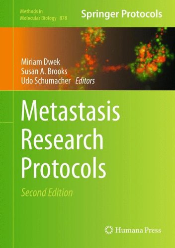 Metastasis Research Protocols 2nd Edition Susan A Brooks Auth