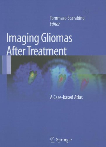 Imaging Gliomas After Treatment A Casebased Atlas 1st Edition Saverio Pollice