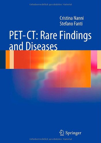 Petct Rare Findings And Diseases 1st Edition Cristina Nanni