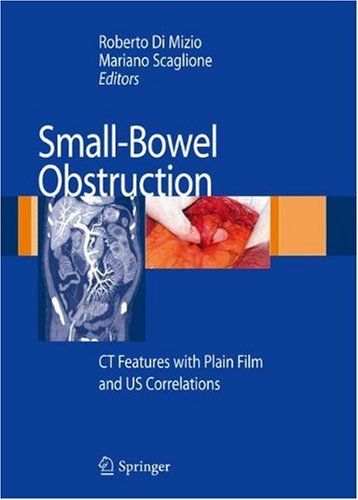 Smallbowel Obstruction Ct Features With Plain Film And Us Correlations 1st Edition Roberto Di Mizio