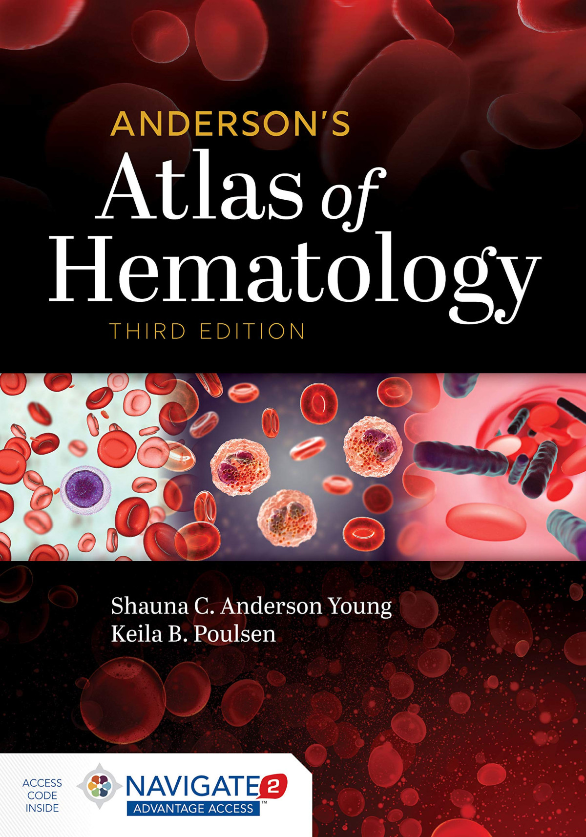 Andersons Atlas Of Hematology Third Edition 3rd Edition Shauna C Anderson Young Keila B Poulsen