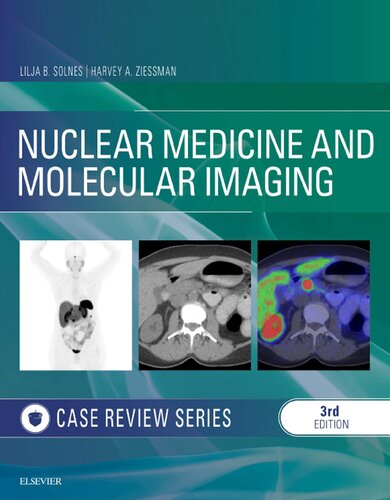 Nuclear Medicine And Molecular Imaging Case Review Series 3rd Edition Lilja Solnes