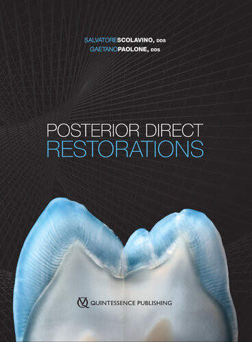 Posterior Direct Restorations Salvatore Scolavino Gaetano Paolone