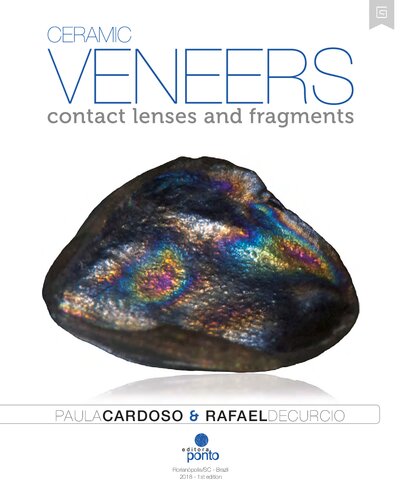 Ceramic Veneers Contact Lenses And Fragments 1st Edition Paula Cardoso Rafael Decurcio