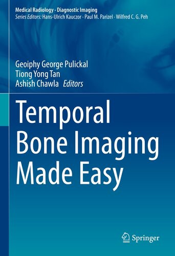 Temporal Bone Imaging Made Easy Geoiphy George Pulickal Tiong Yong Tan Ashish Chawla