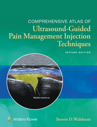 Comprehensive Atlas Of Ultrasoundguided Pain Management Injection Techniques 2nd Edition Steven D Waldman