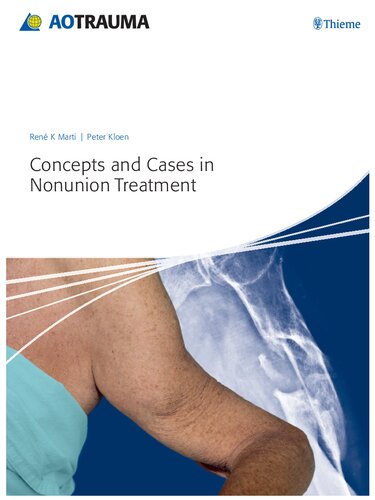 Concepts And Cases In Nonunion Treatment 1st Edition Ren K Marti
