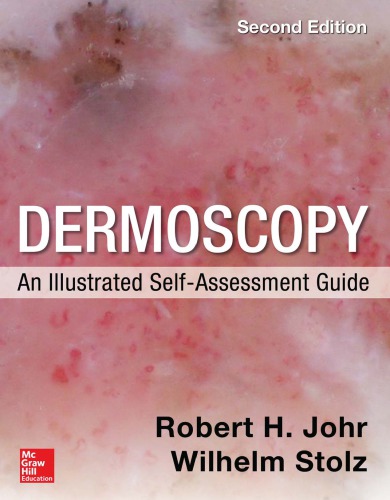 Dermoscopy An Illustrated Selfassessment Guide 2 Ed 2nd Edition Johr Robert H Stolz Wilhelm