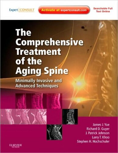 The Comprehensive Treatment Of The Aging Spine Minimally Invasive And Advanced Techniques James Joseph Yue