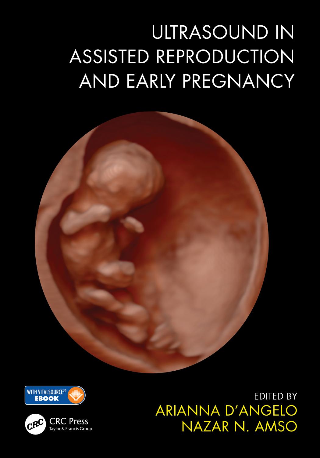 Ultrasound In Assisted Reproduction And Early Pregnancy Arianna Dangelo Nazar N Amso Arianna Dangelo Nazar N Amso