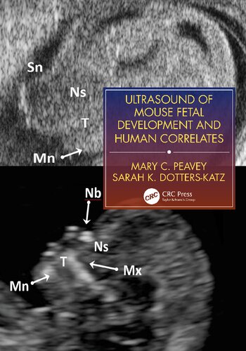 Ultrasound Of Mouse Fetal Development And Human Correlates 1st Edition Mary C Peavey Sarah K Dotterskatz