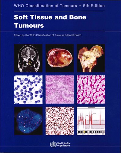 Soft Tissue And Bone Tumours Who Classification Of Tumours Medicine 5th Edition Who Classification Of Tumours Editorial Board