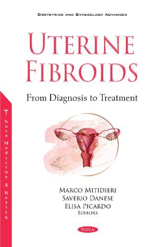 Uterine Fibroids From Diagnosis To Treatment Marco Mitidieri Saverio Danese Elisa Picardo