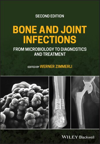 Bone And Joint Infections From Microbiology To Diagnostics And Treatment 2nd Edition Werner Zimmerli
