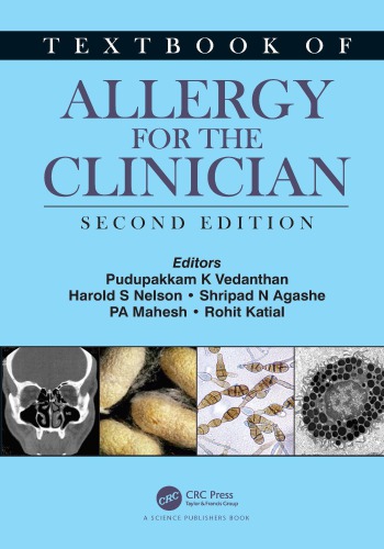 Textbook Of Allergy For The Clinician 2nd Edition Pudupakkam K Vedanthan
