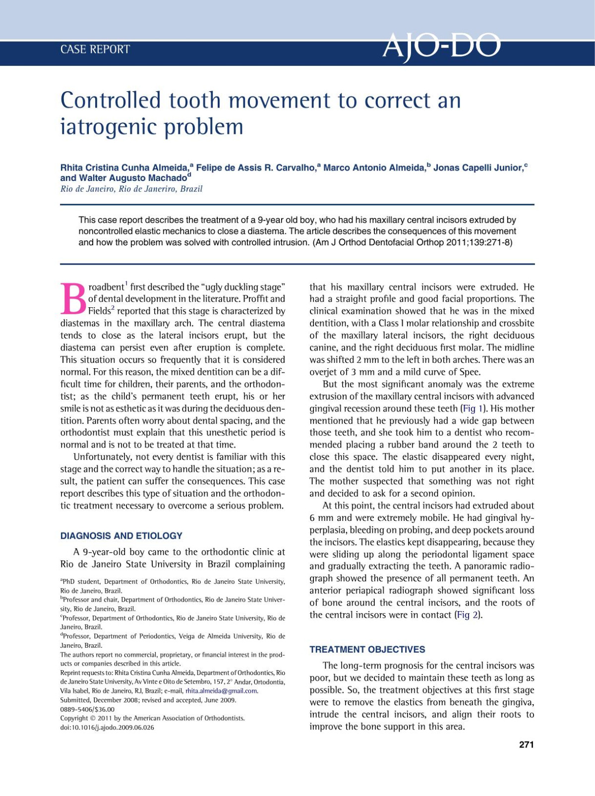 Controlled Tooth Movement To Correct An Iatrogenic Problem Rhita Cristina Cunha Almeida