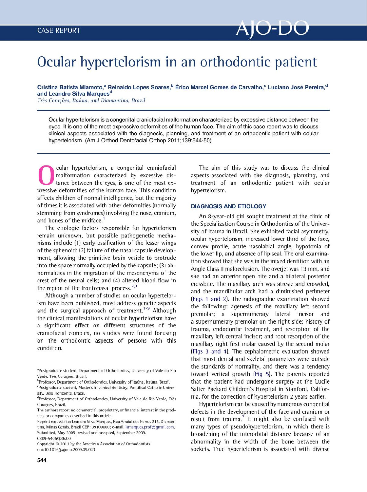 Ocular Hypertelorism In An Orthodontic Patient Cristina Batista Miamoto Reinaldo Lopes Soares Rico Marcel Gomes De Carvalho Luciano Jos Pereira Leandro Silva Marques