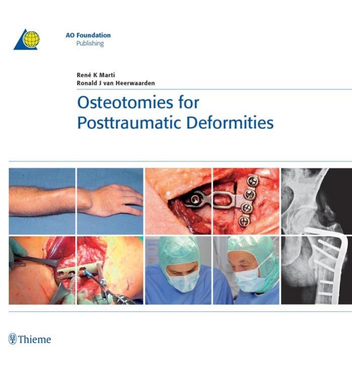 Osteotomies For Posttraumatic Deformities Aopublishing Thieme 2008tls Marti