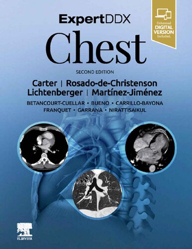 Expertddx Chest 2nd Edition Brett W Carter Iii John P Lichtenberger Santiago Martinezjimenez Melissa L Rosadodechristenson