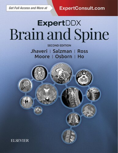 Expertddx Brain And Spine 2nd Edition Miral D Jhaveri Karen L Salzman