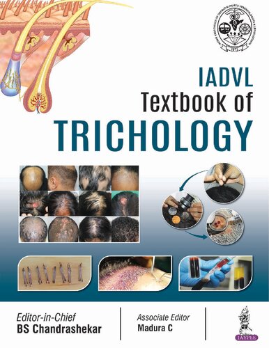 Iadvl Textbook Of Trichology 1st Edition Md Chandrashekar B S