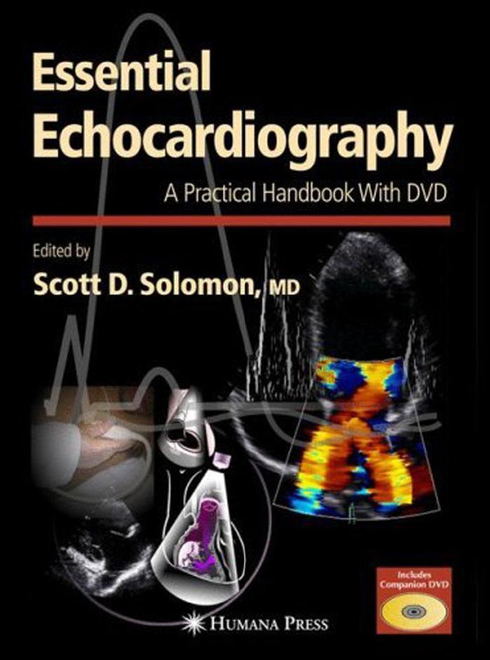 Essential Echocardiography A Practical Handbook With Dvd Solomon