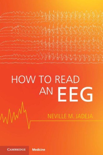 How To Read An Eeg 1st Neville M Jadeja