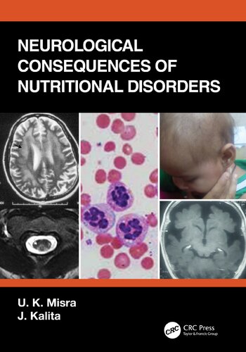 Neurological Consequences Of Nutritional Disorders U K Misra