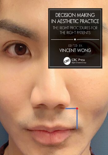 Decision Making In Aesthetic Practice The Right Procedures For The Right Patients 1st Edition Vincent Wong