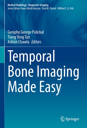 Temporal Bone Imaging Made Easy 1st Edition Geoiphy George Pulickal
