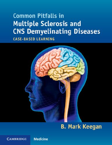 Common Pitfalls In Multiple Sclerosis And Cns Demyelinating Diseases Casebased Learning Illustrated B Mark Keegan