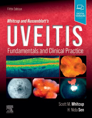 Whitcup And Nussenblatts Uveitis Fundamentals And Clinical Practice 5th Edition Scott M Whitcup Md