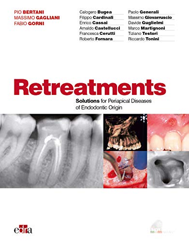 Retreatment Solutions For Periapical Diseases Of Endodontic Origin 1st Edition Pio Bertani