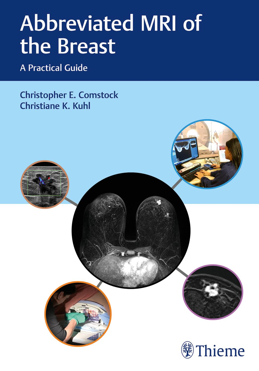 Abbreviated Mri Of The Breast A Practical Guide Christopher E Comstock