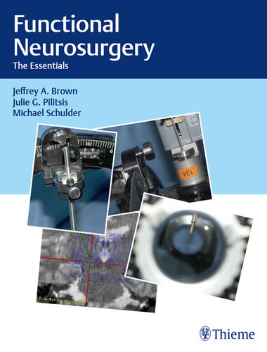 Functional Neurosurgery The Essentials Jeffrey A Brown Julie G Pilitsis