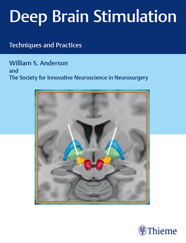 Deep Brain Stimulation Techniques And Practices William S Anderson