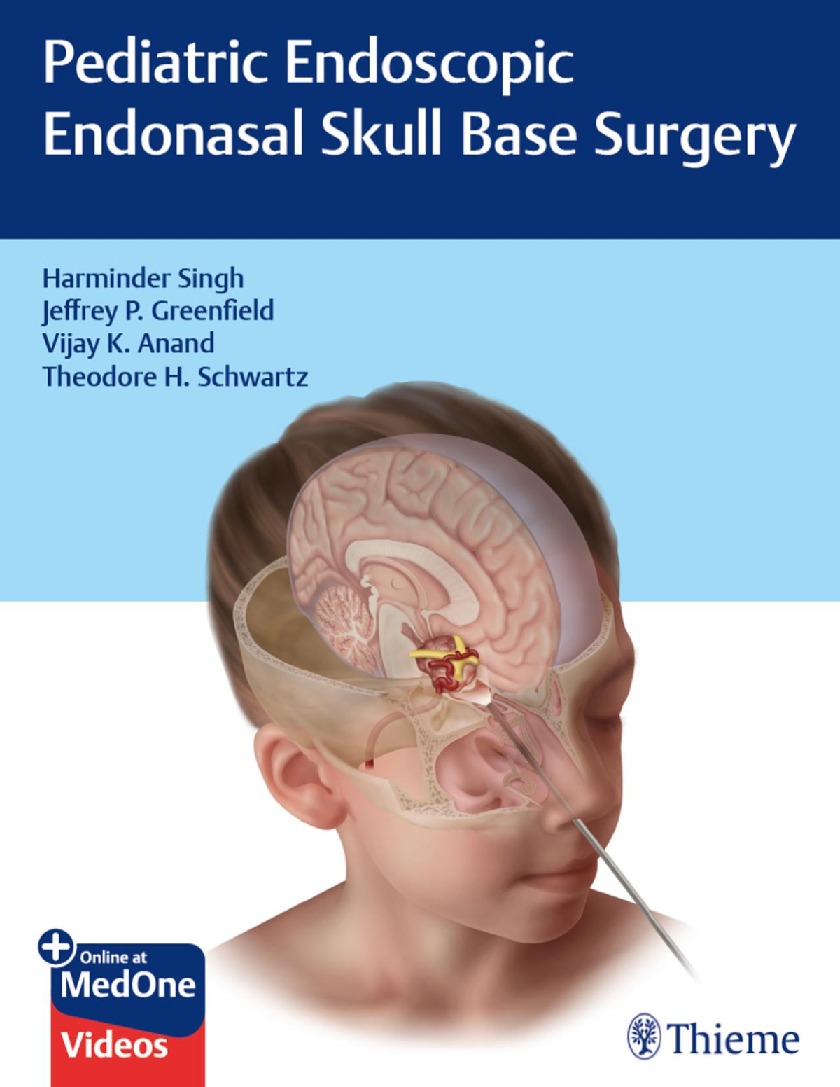 Pediatric Endoscopic Endonasal Skull Base Surgery Harminder Singh