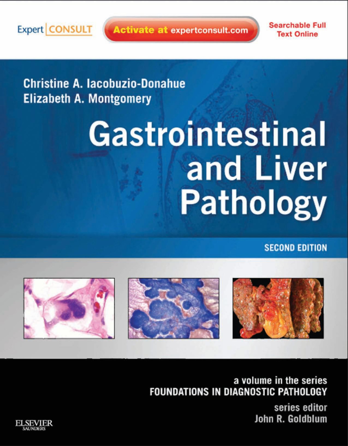 Gastrointestinal And Liver Pathology 2nd Edition Christine A Iacobuziodonahue