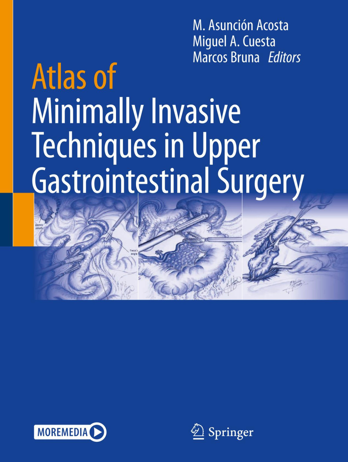 Atlas Of Minimally Invasive Techniques In Upper Gastrointestinal Surgery M Asuncin Acosta