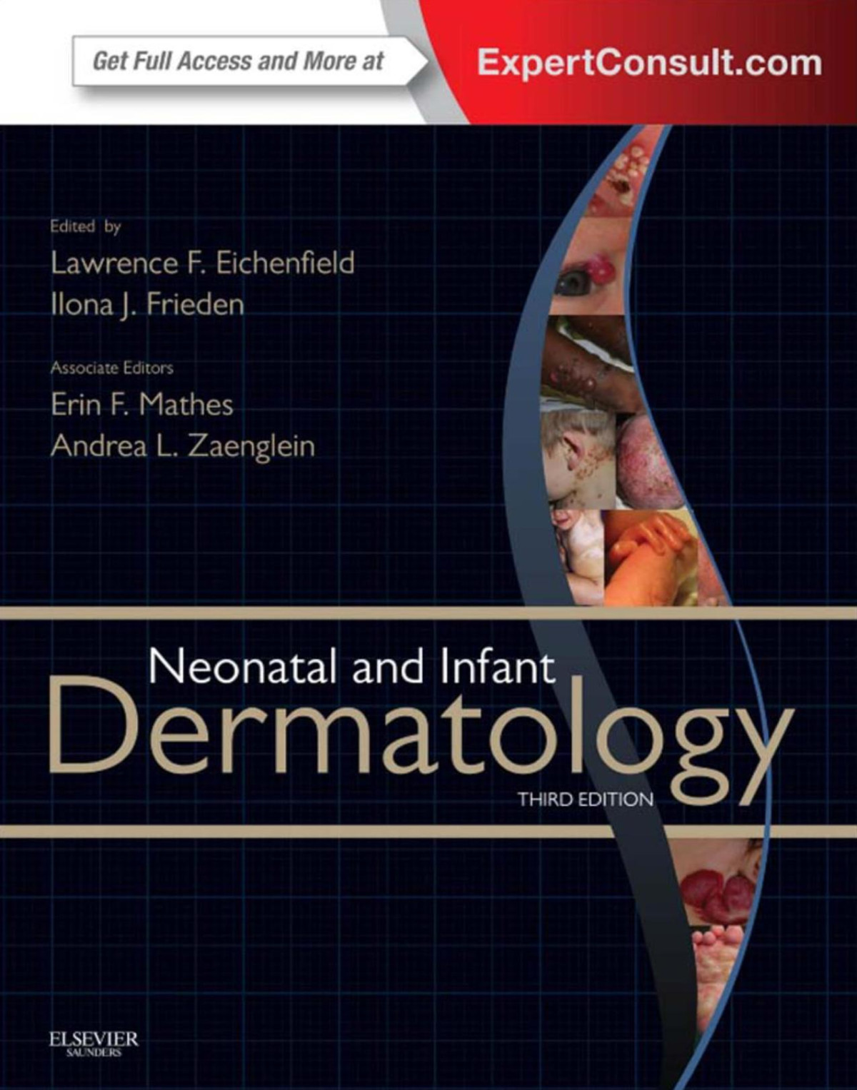 Neonatal And Infant Dermatology 3rd Edition Lawrence F Eichenfield