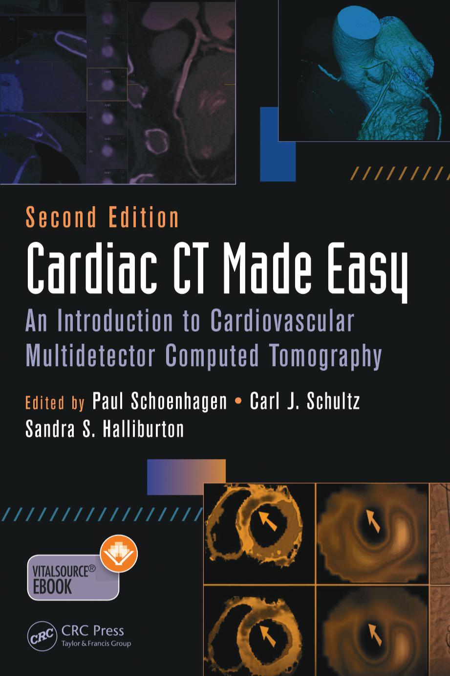 Cardiac Ct Made Easy An Introduction To Cardiovascular Multidetector Computed Tomography 2nd Edition Paul Schoenhagen