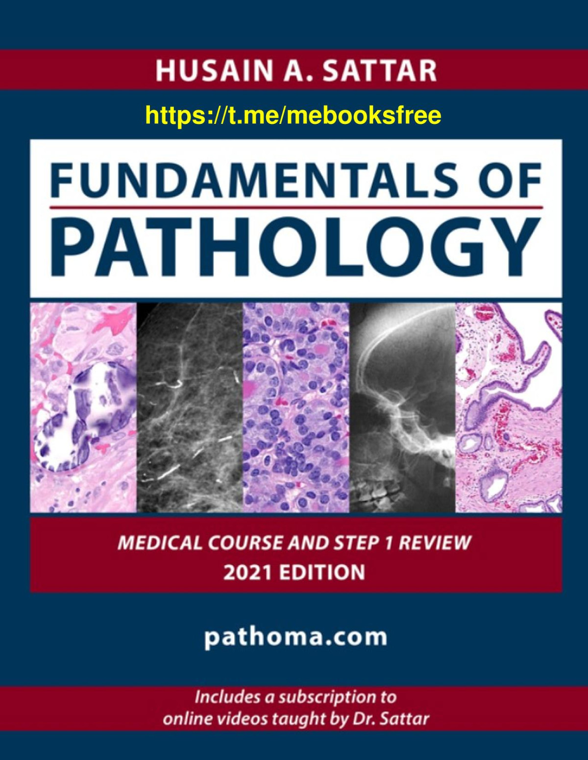 Fundamentals Of Pathology Medical Course And Step 1 Review 2021 Edition Sattar Husain A